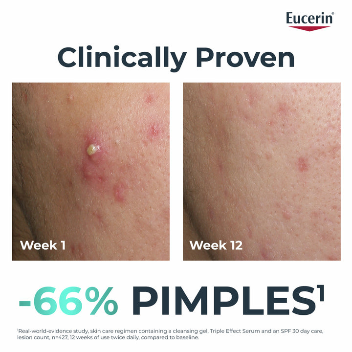 Eucerin Dermopurfyr Post Blemish 3x Effect Serum 40ml