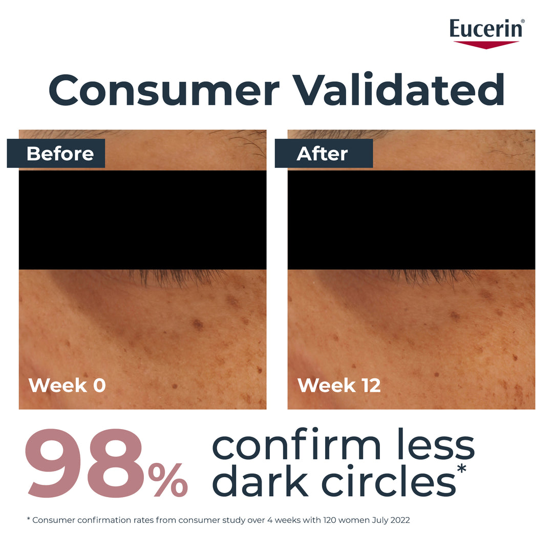 Eucerin Even Pigment Dark Circle Eye Cream 15ml