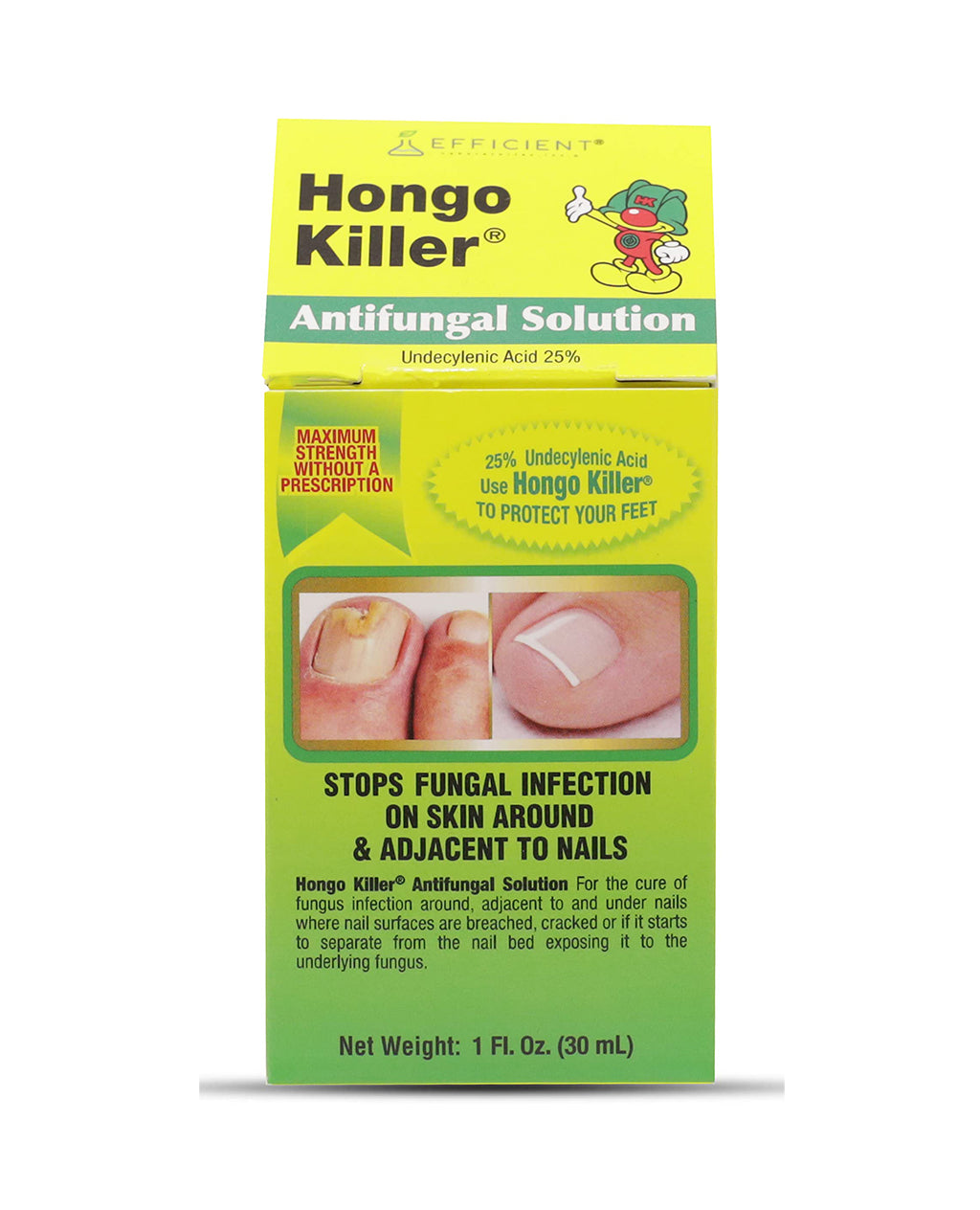 Hongo Killer Antifungal Solution 30ml