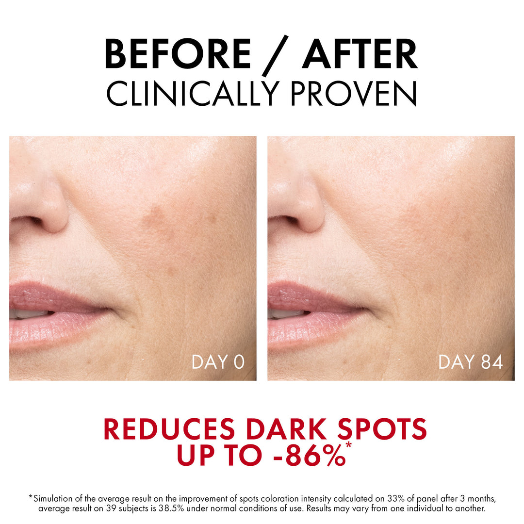 Vichy Liftactiv B3 Serum 30Ml