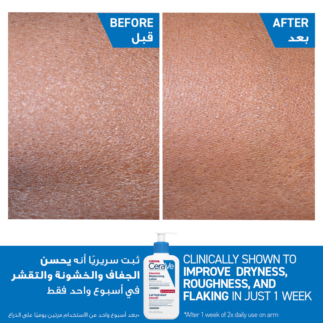 Cerave Intense Moist Lotion 236Ml