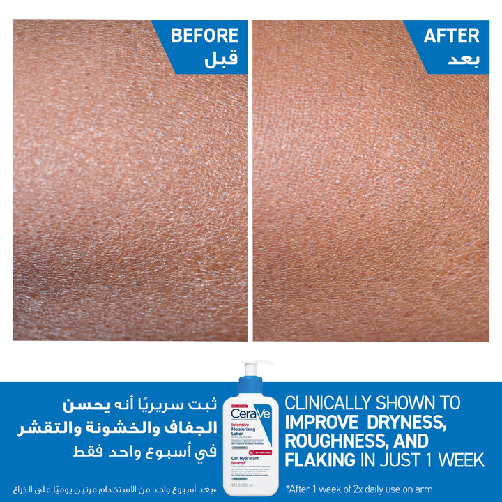 Cerave Intense Moist Lotion 236Ml