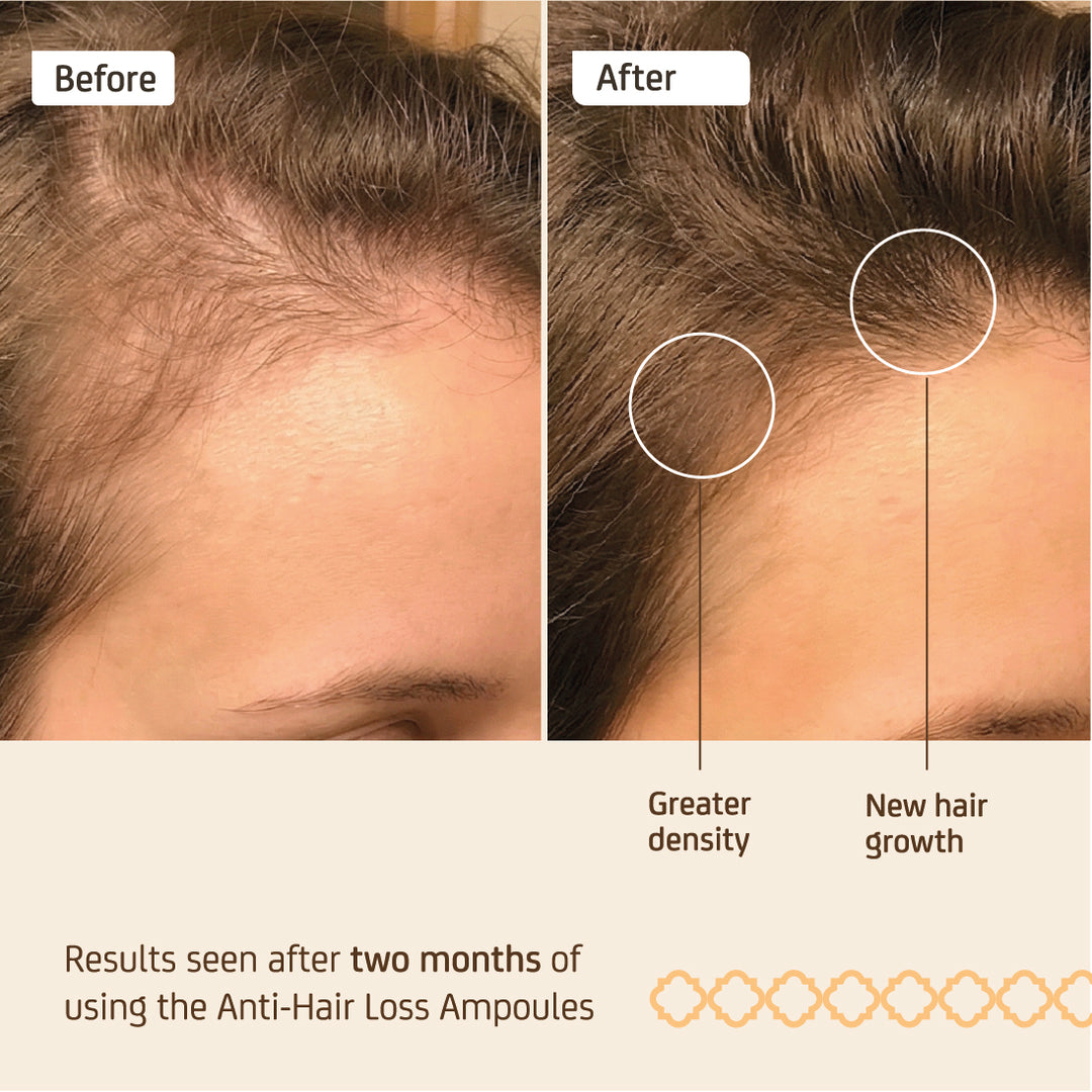 NUGGELA EFFECTIVE ANTI-HAIR LOSS AMP 10ML 4S