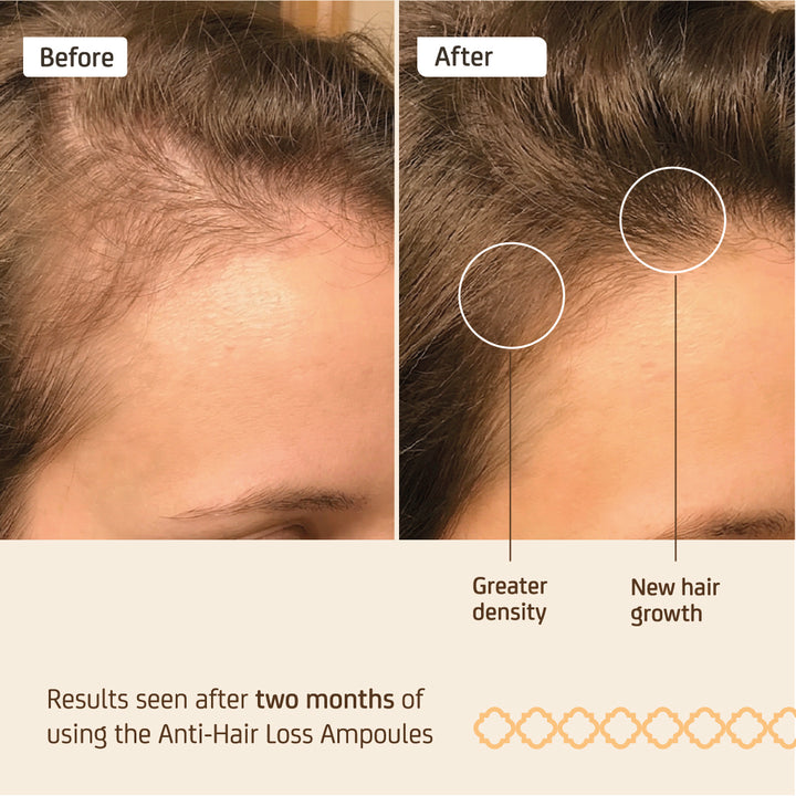 NUGGELA EFFECTIVE ANTI-HAIR LOSS AMP 10ML 4S