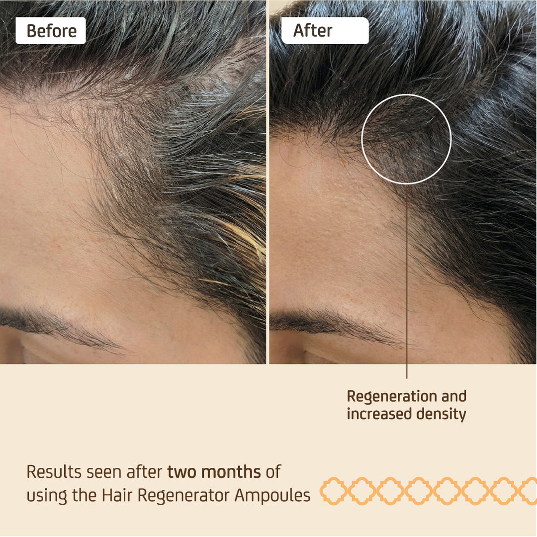 NUGGELA HAIR REGENERATOR AMP 10ML 4S