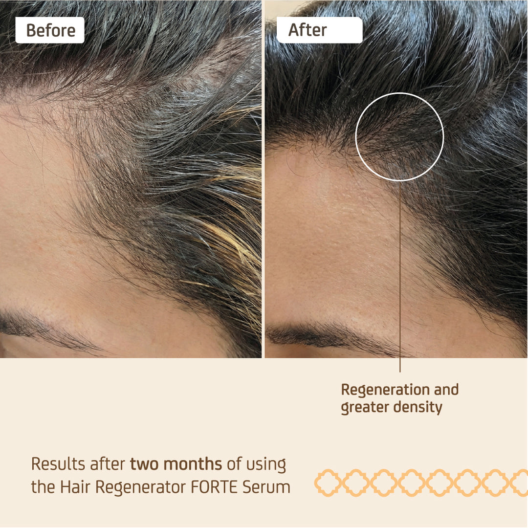 Nuggela Forte Hair Regenerator Serum 70Ml