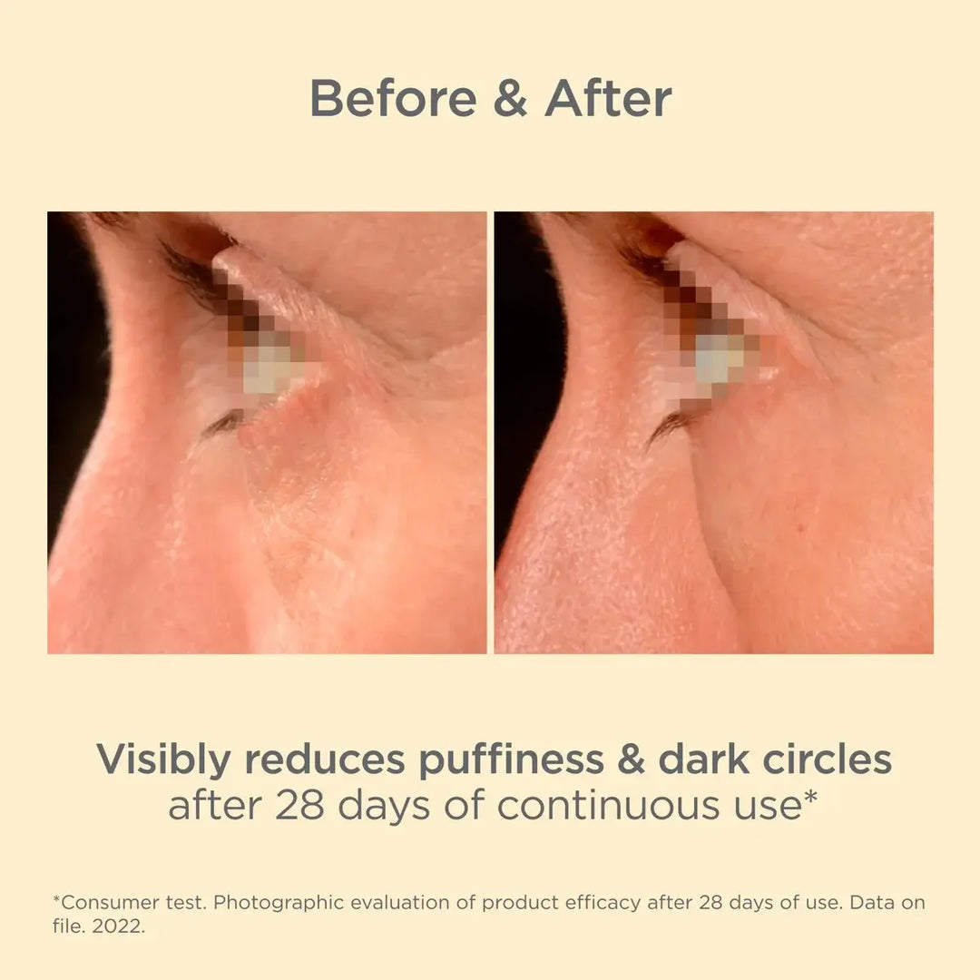 Before and after comparison of eye area showing visible reduction in puffiness and dark circles after 28 days using ISDIN Isdinceutics Rejuvenate K-Ox Eyes Cream