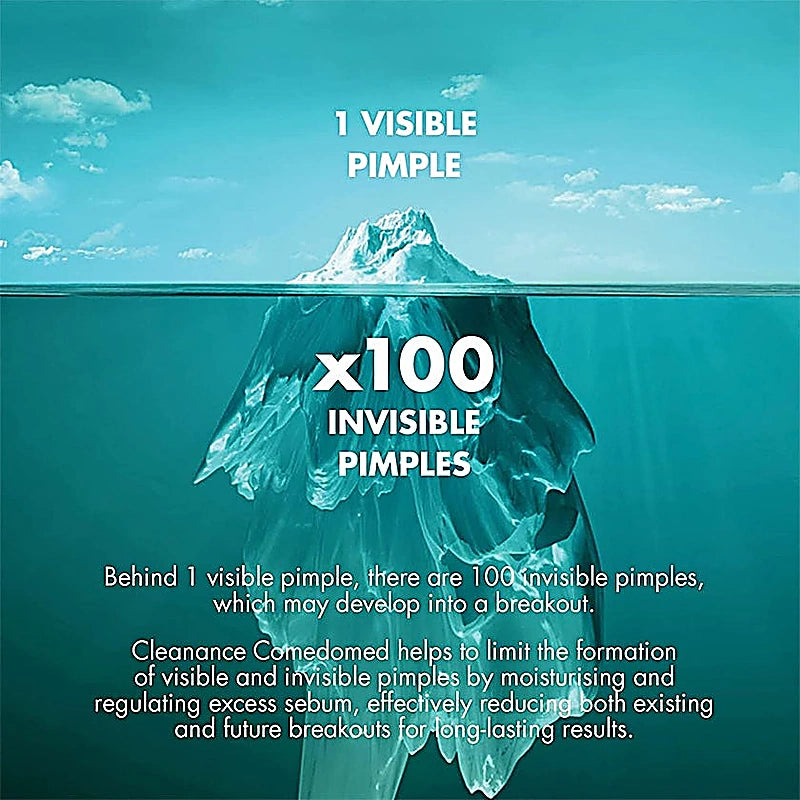 Avene Cleanance Comedomed Concentrate 30ml