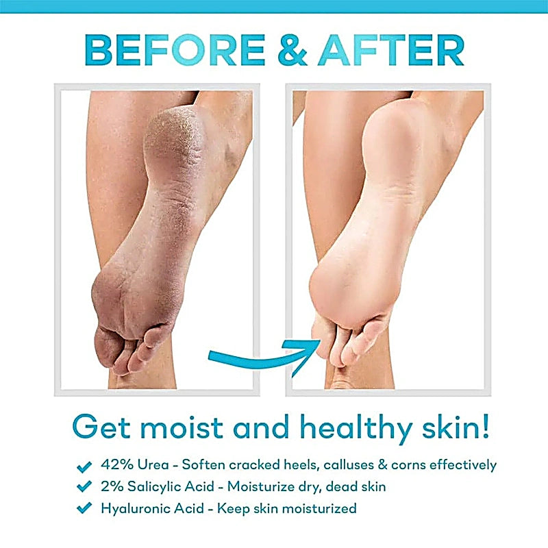 Cerave Sa Renewing Foot Cream 88Ml