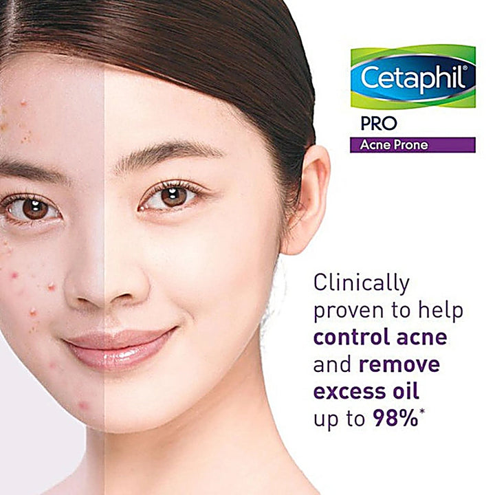 Cetaphil Pro Acne Foam Wash 235ml