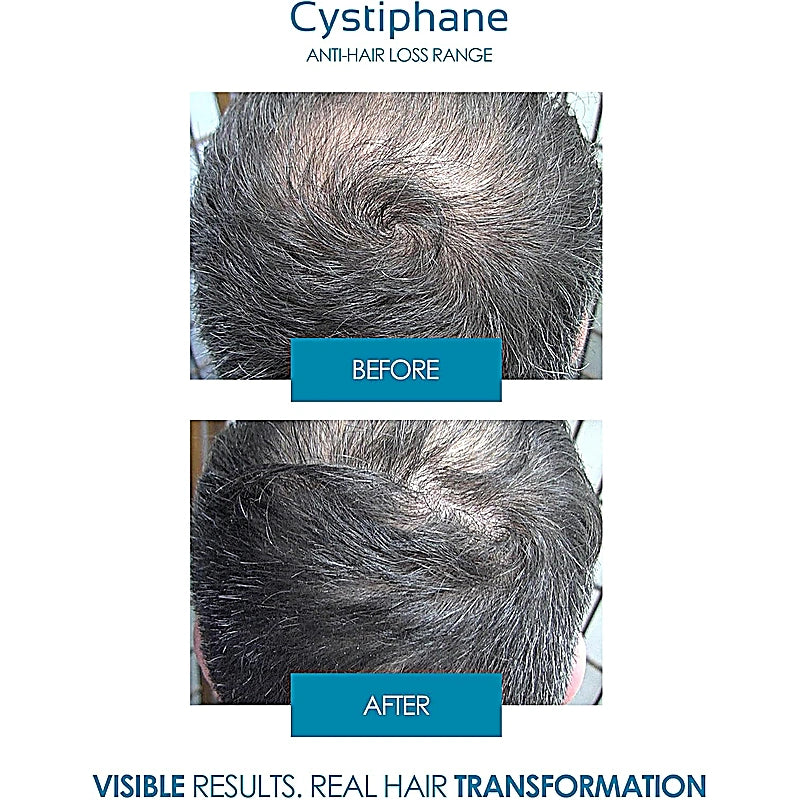 Cystiphane Anti Hairloss Lotion 125ml