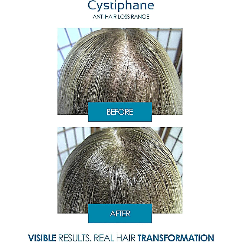 Cystiphane Tablets 120s