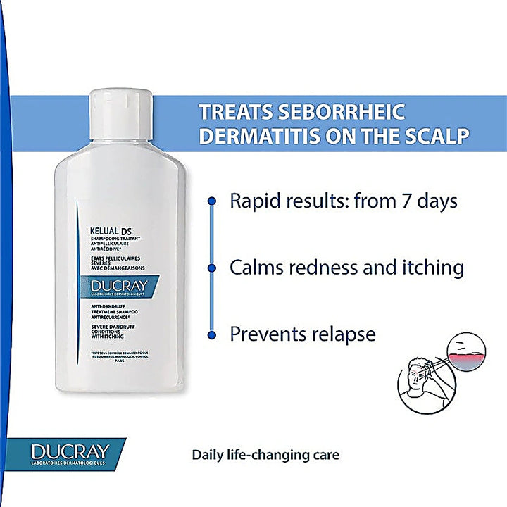 Ducray Kelual DS Shampoo Anti Dandruff - Scalp Soothing