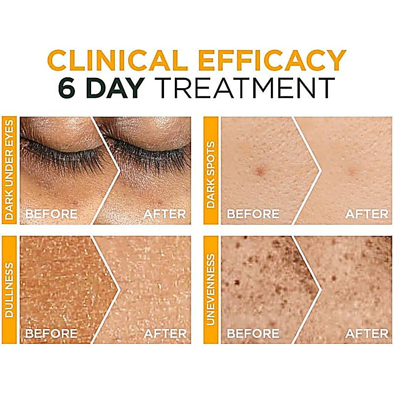 Garnier Fast Bright 3% Vitamin C 1.5ml 12s