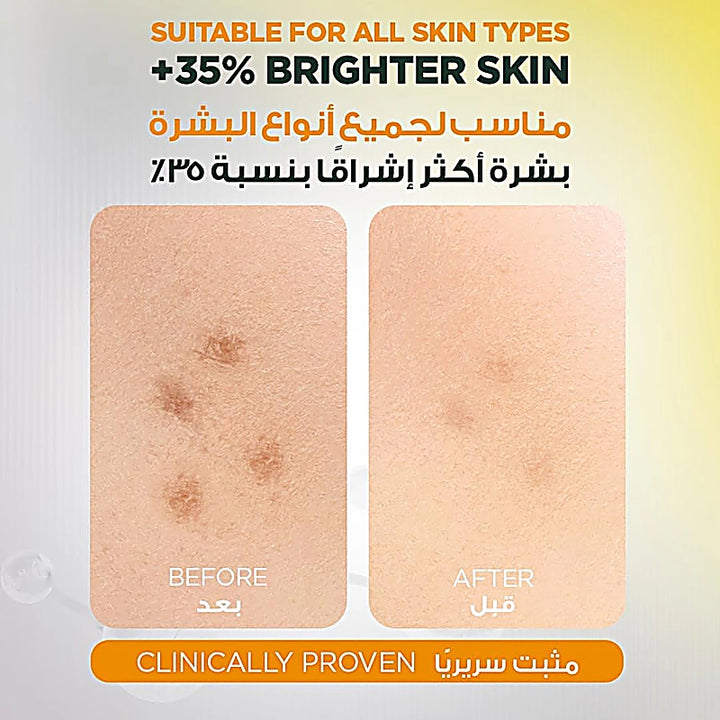 Garnier Fast Bright 30X Vit C Booster Serum 30ml
