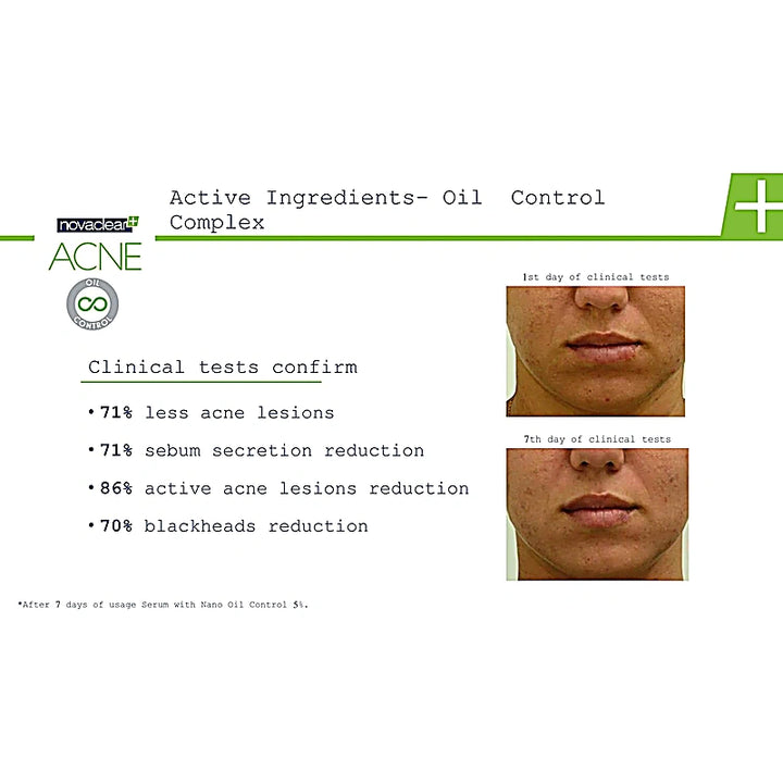 Novaclear Acne Oil Control Kit 3s