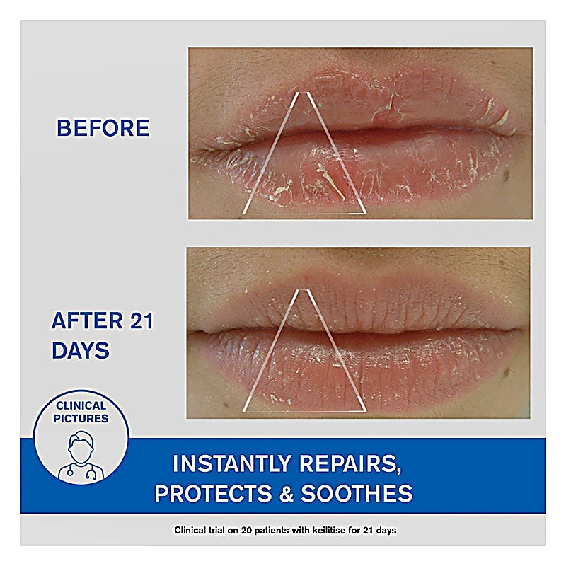 Uriage Bariederm Lip Balm 15ml