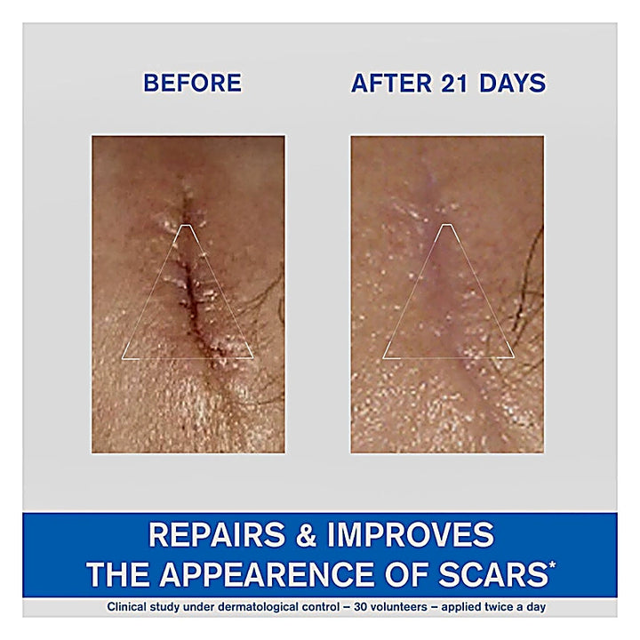 Uriage Bariederm Cica Cream